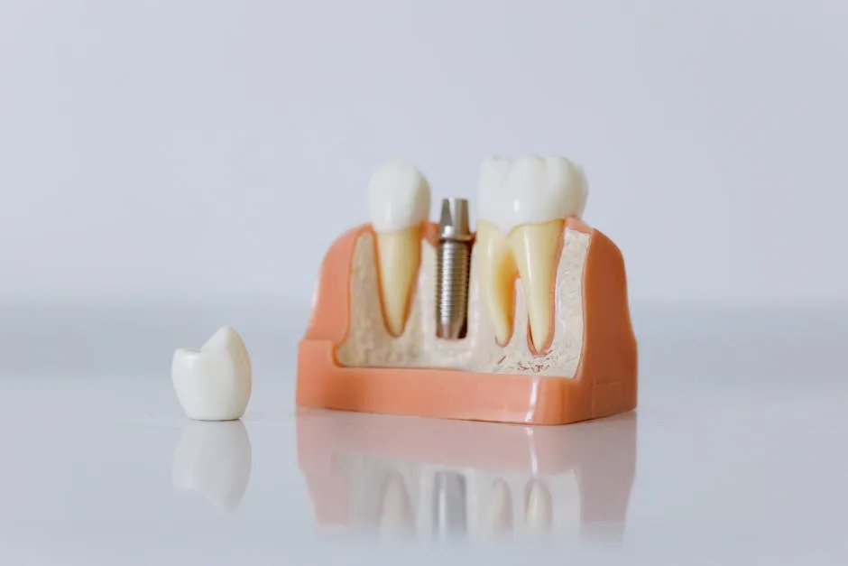 Dental Implants vs. Dentures: Which Is Better for You?