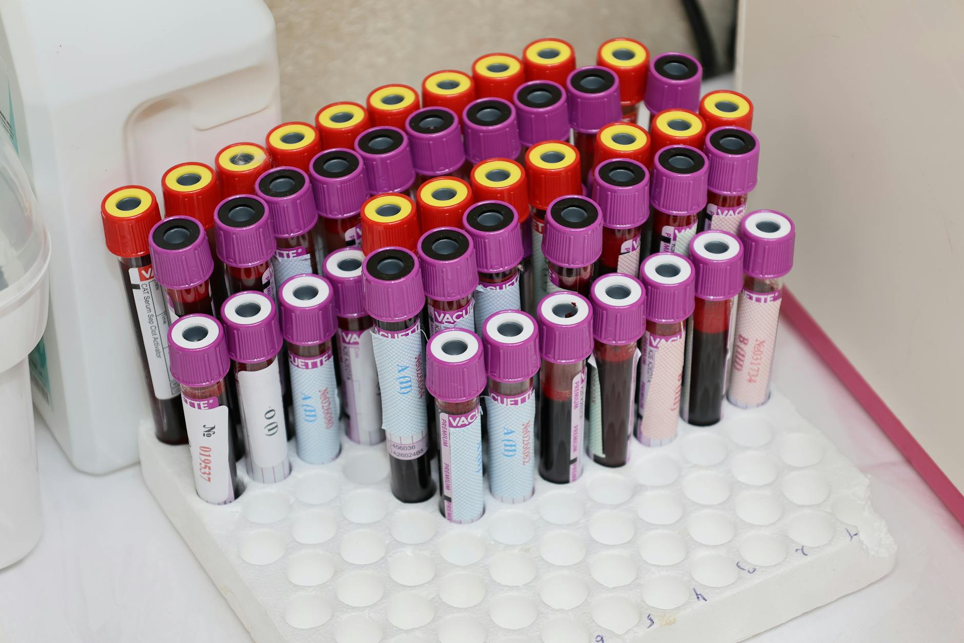 Advancements in Lung Cancer Screening and PCOS Nomenclature