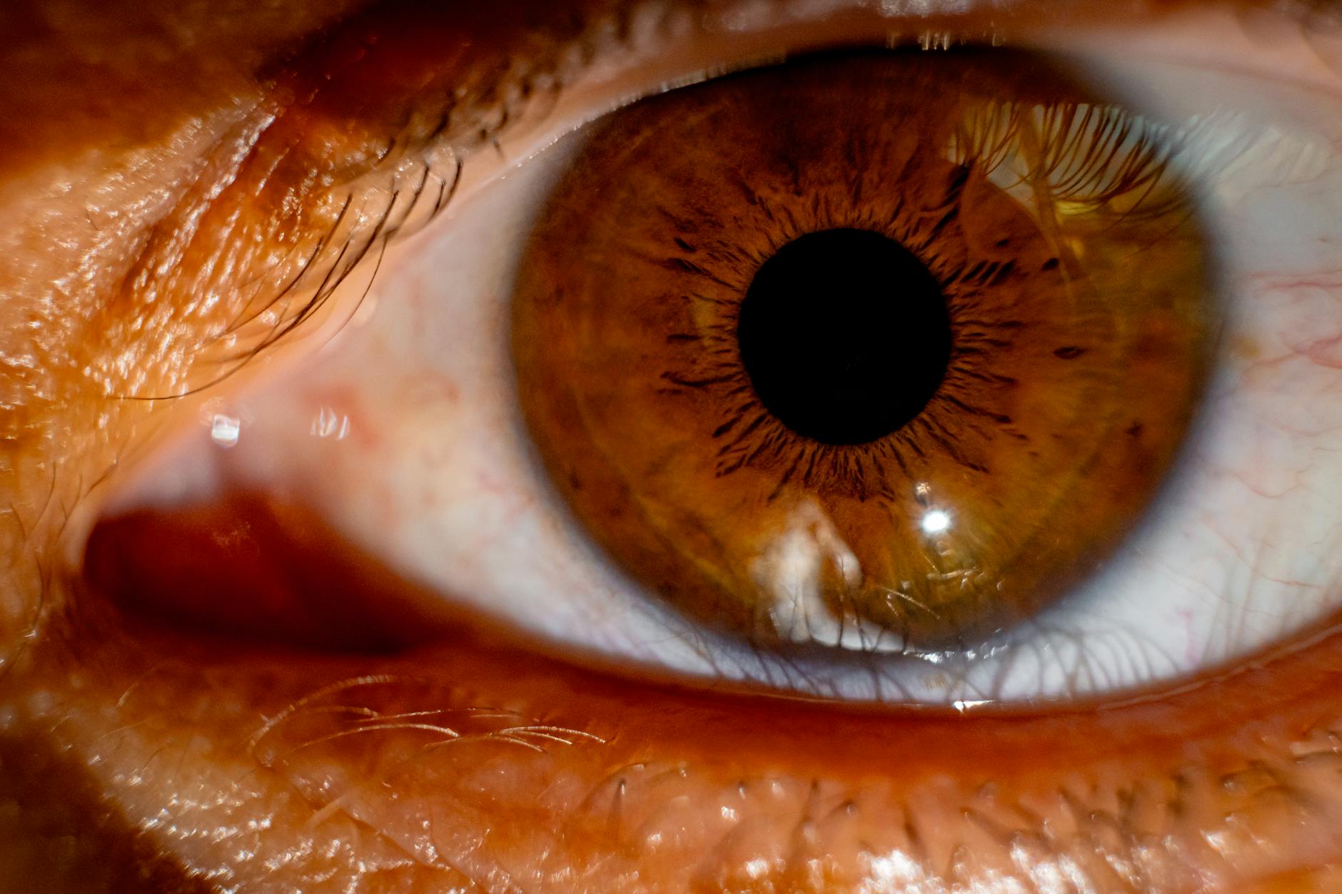 بدون ليزر أو جراحة: تصحيح الرؤية الأكثر أمانًا وفعالية من LASIK